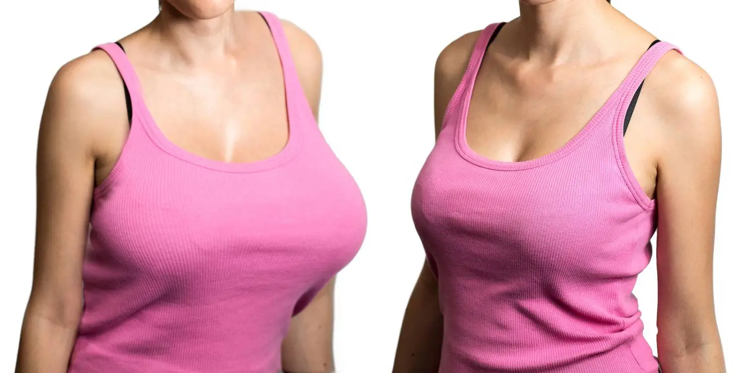 breast augmentation surgery in South florida